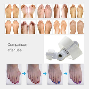 Feet Care Pedicure Tool Bunion Hallux Valgus Corrector Orthopedic Supplies Big Toe Splint Straightener - walk mat